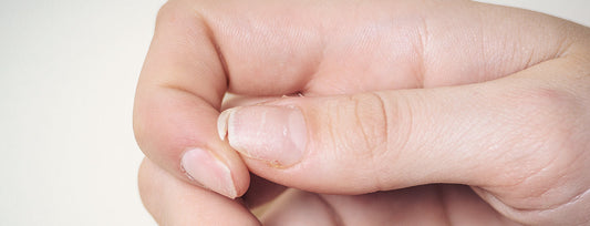 Was hilft gegen brüchige Fingernägel?